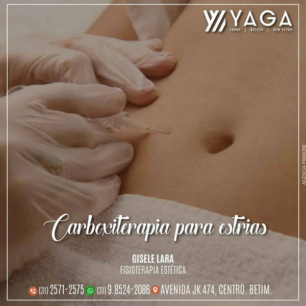 Carboxiterapia para estrias