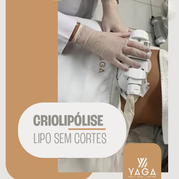 Criolipólise lipo sem cortes