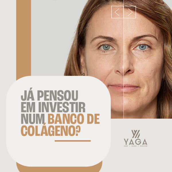 Já pensou em investir num banco de colágeno?