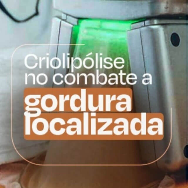 Criolipólise no combate a gordura localizada