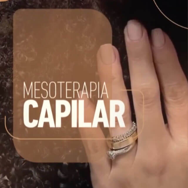 Mesoterapia capilar