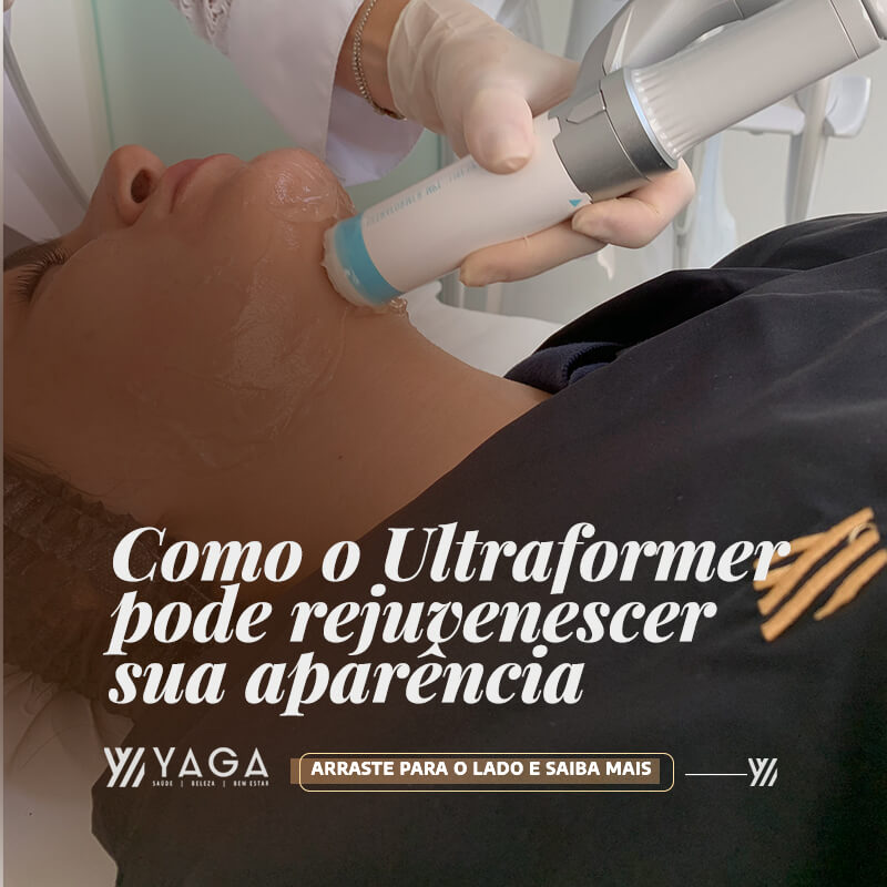 Como o Ultraformer pode rejuvenescer sua aparência