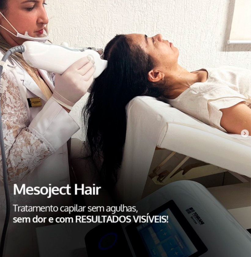 <p>Mesoject Hair: Tratamento capilar sem agulhas, sem dor e com resultados visíveis!</p>