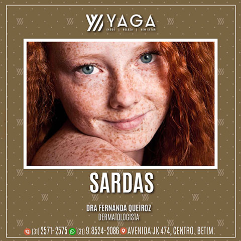 Sardas
