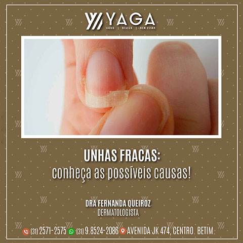 Unhas fracas: Conheça as possíveis causas!
