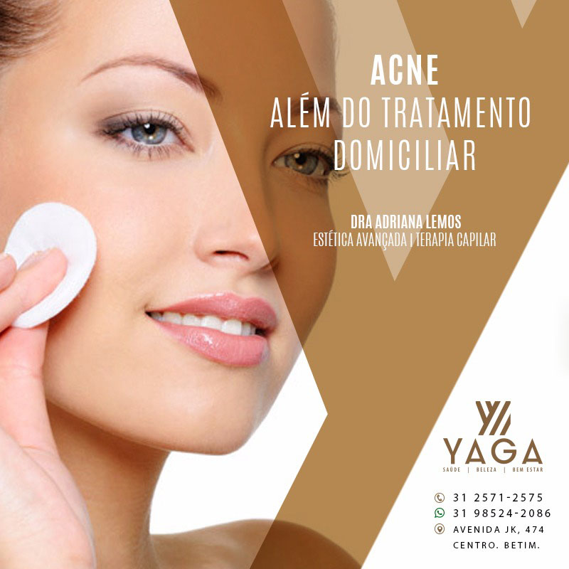 Acne além do tratamento domiciliar