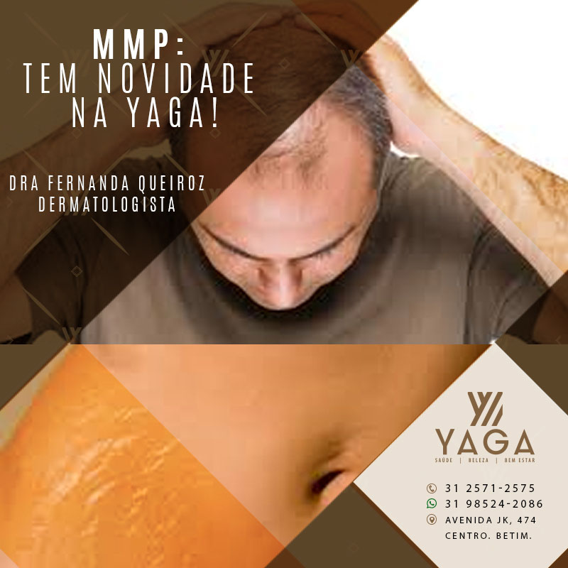 MMP : Tem novidade na Yaga!