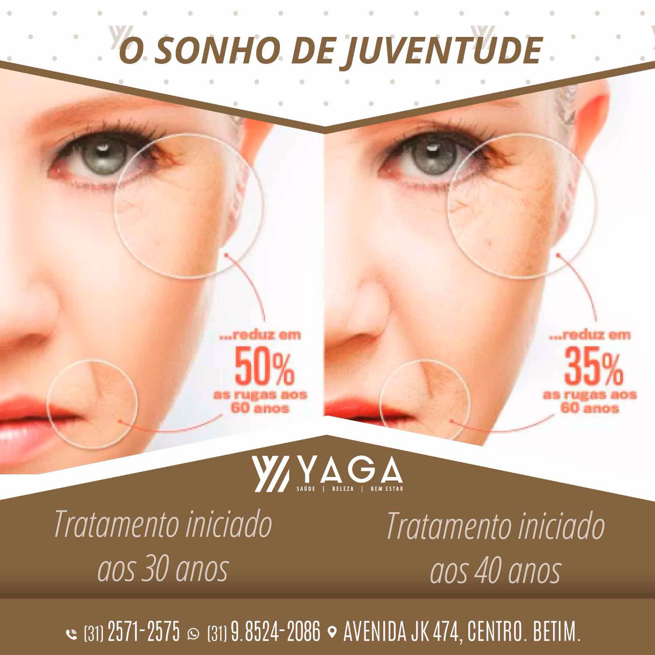 Prejuvenation - O sonho da juventude