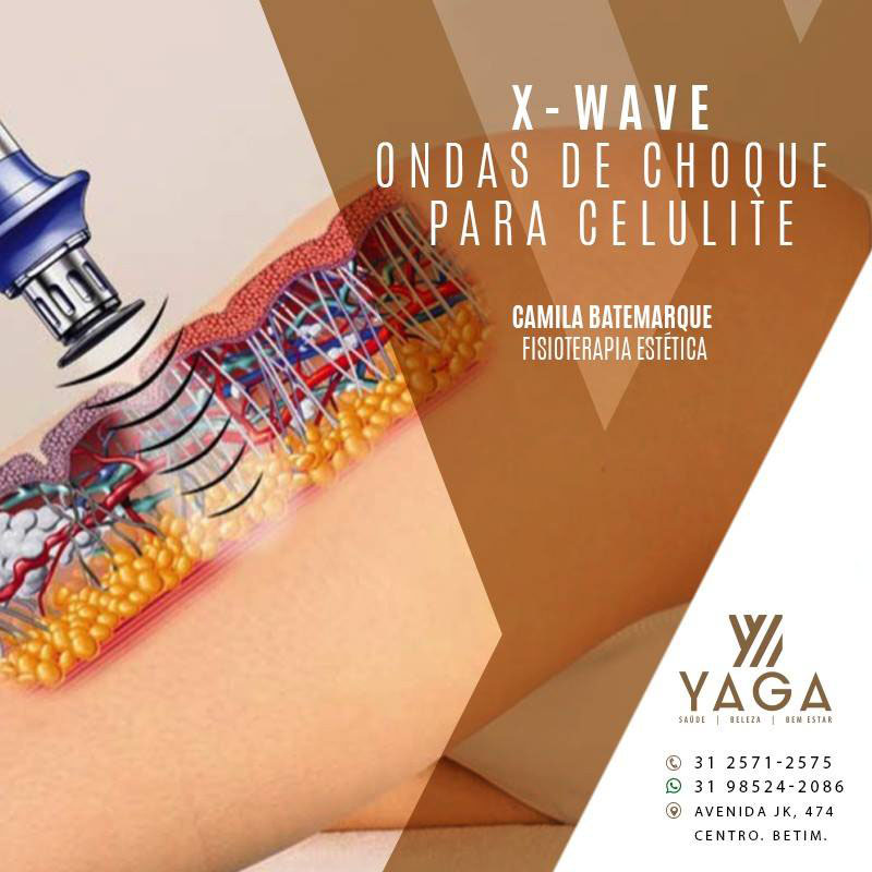 X-Wave: Ondas de Choque para Celulite