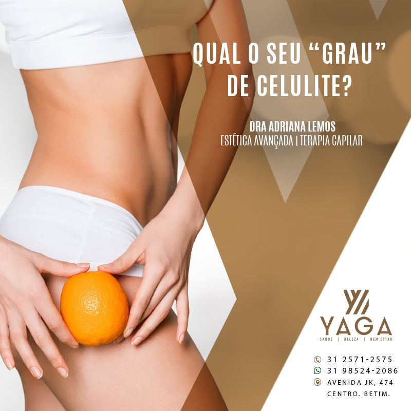 Qual o seu &ldquo;grau&rdquo; de celulite?