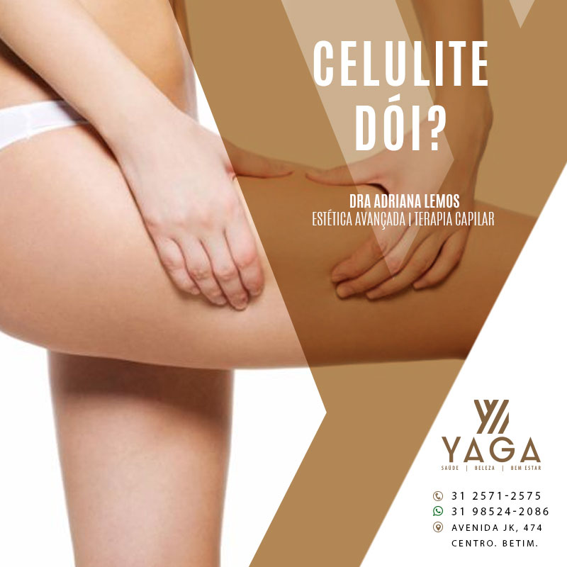 Celulite d&oacute;i?