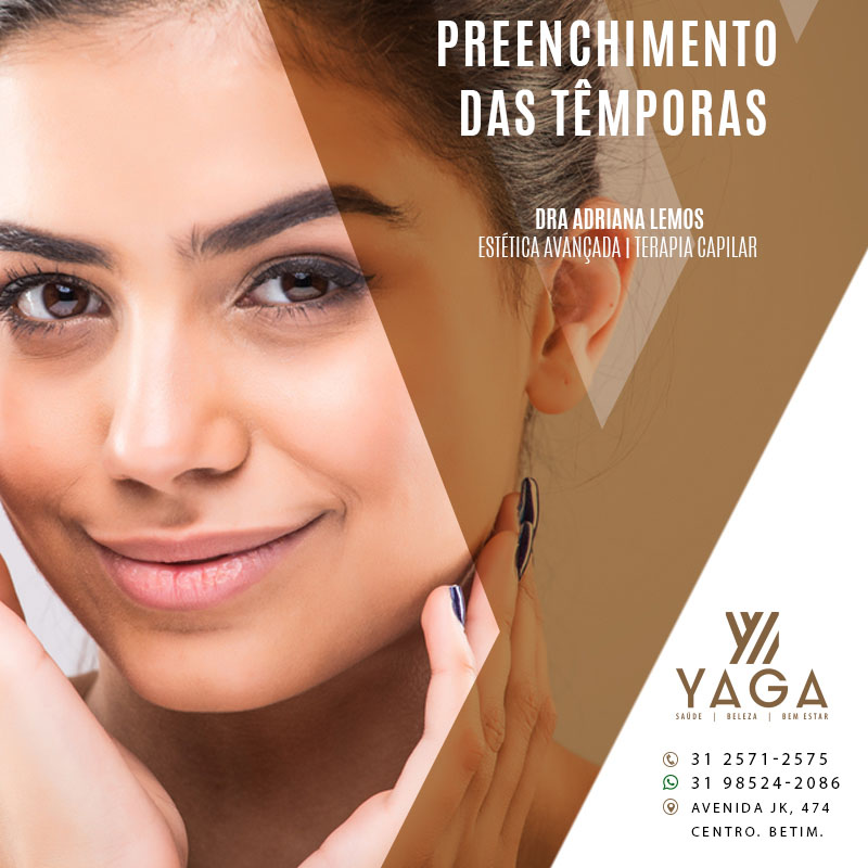 Preenchimento das têmporas