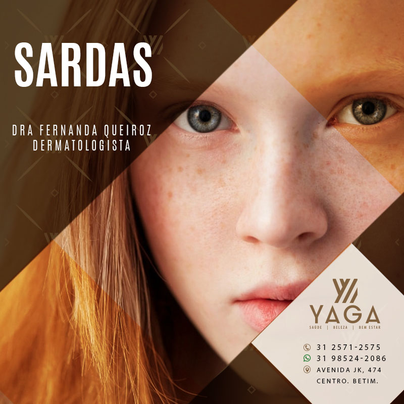Sardas