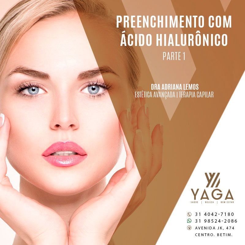 Preenchimento com &Aacute;cido Hialur&ocirc;nico - Parte 1