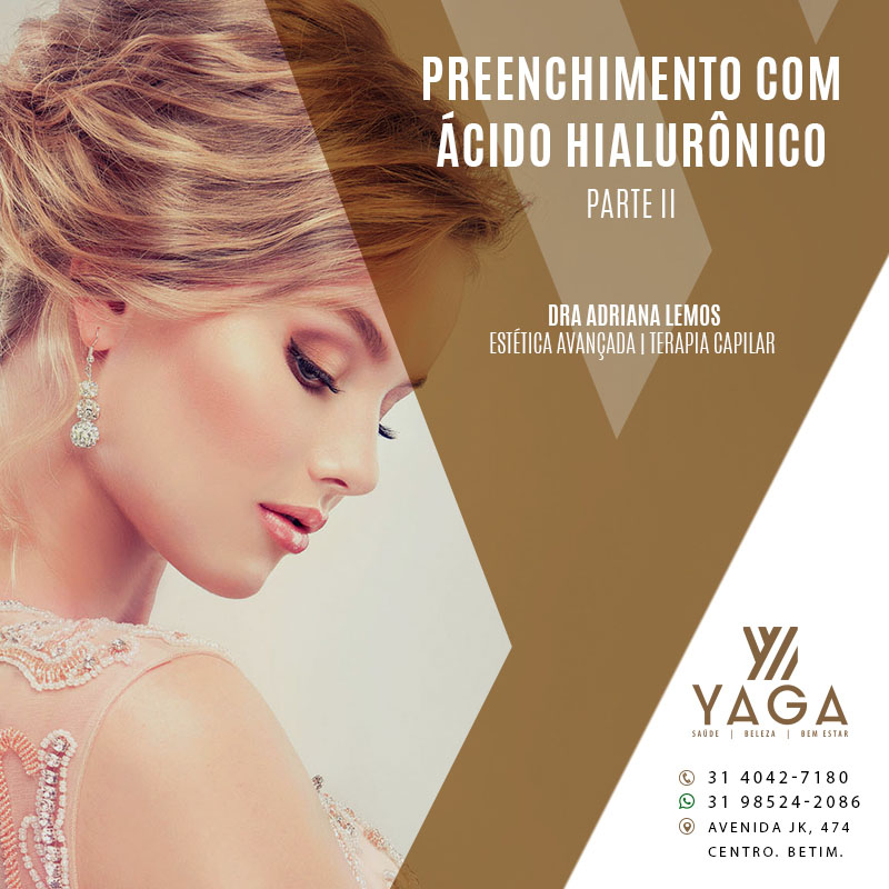 Preenchimento com &Aacute;cido Hialur&ocirc;nico - Parte 2