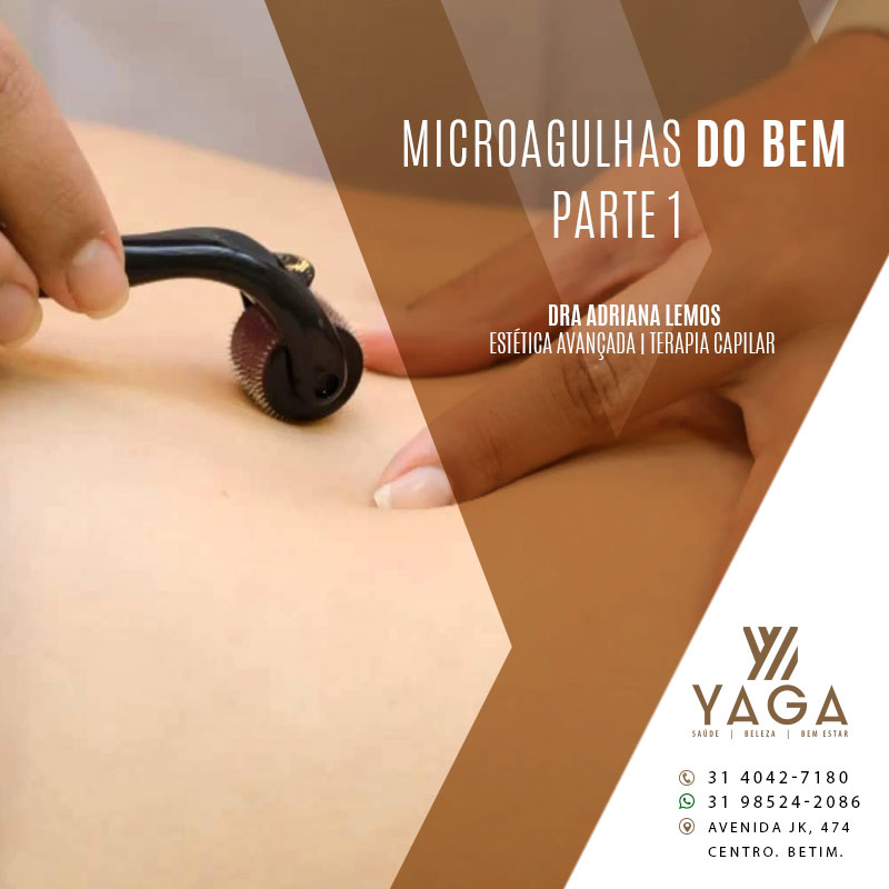 Microagulhas do bem - Parte 1