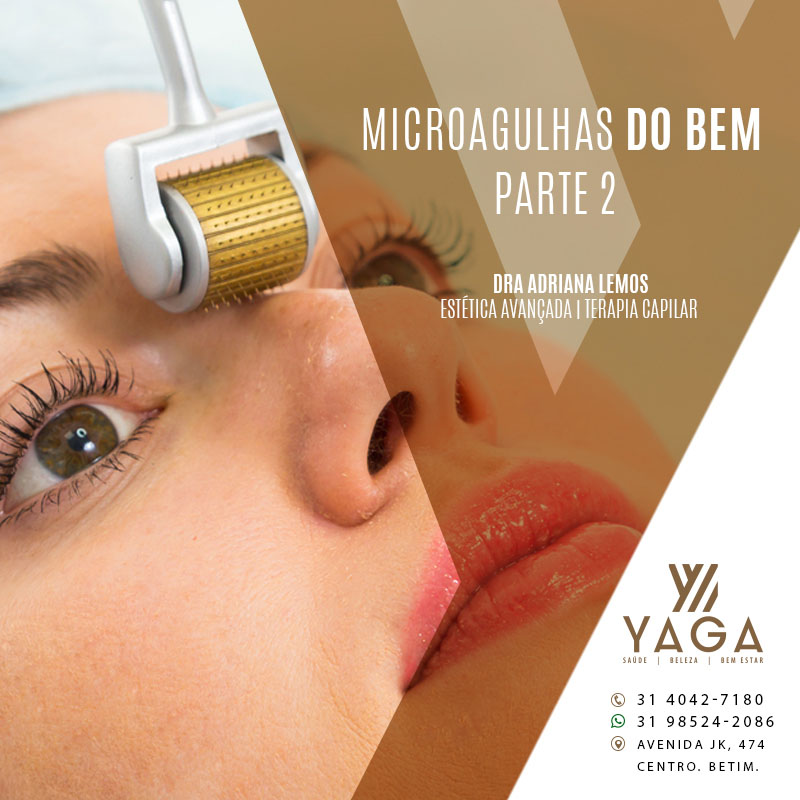 Microagulhas do bem - parte 2