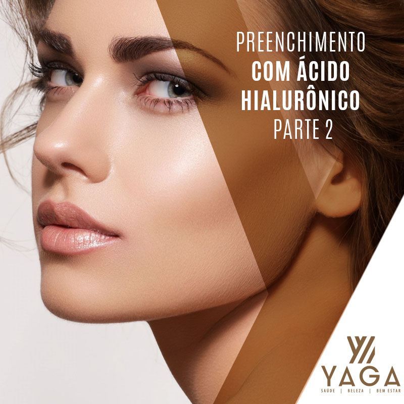 Preenchimento com &aacute;cido hialur&ocirc;nico - Parte 2