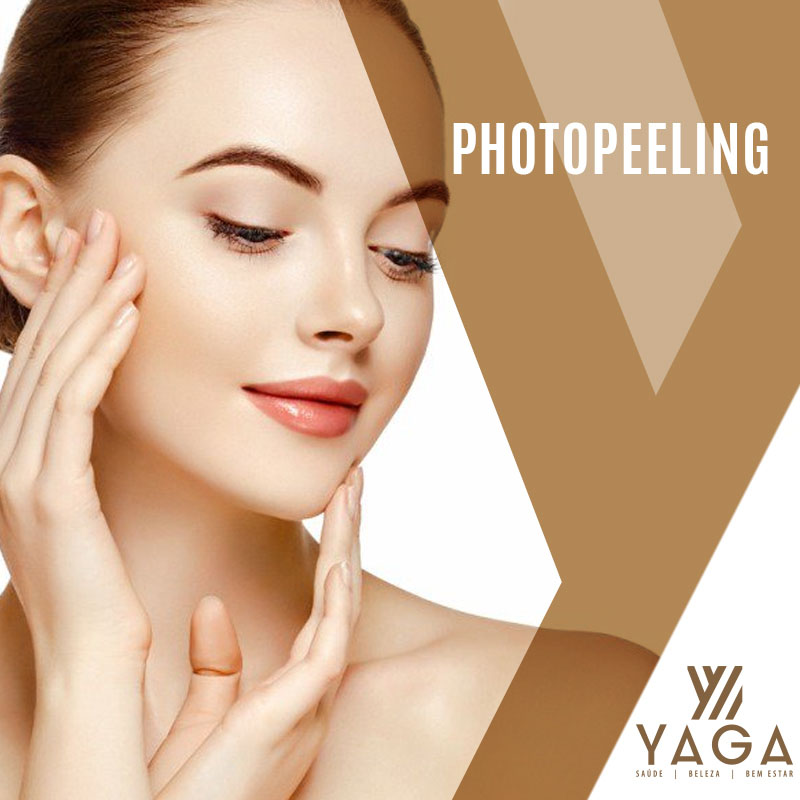 Photopeeling
