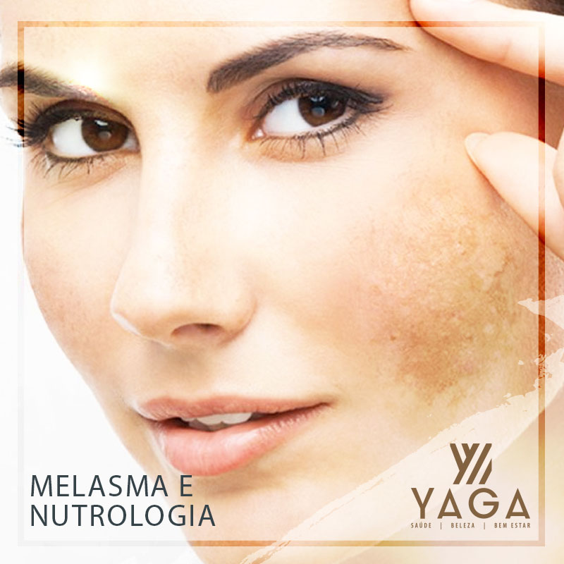 Melasma e Nutrologia