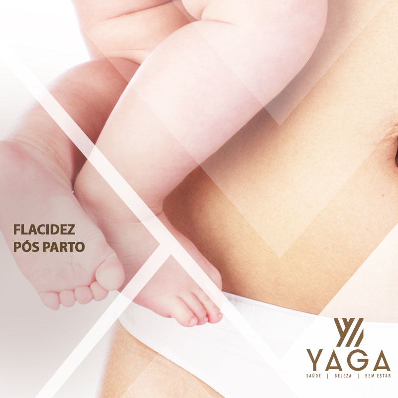 Flacidez p&oacute;s parto