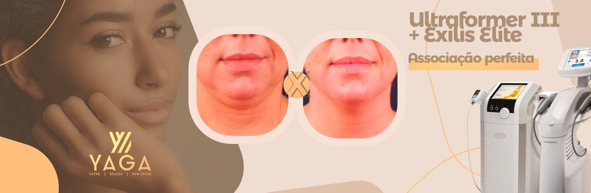 Ultraformer III + Exilis Elite