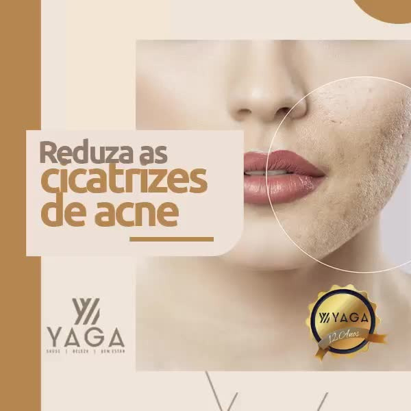 Reduza as cicatrizes de acne