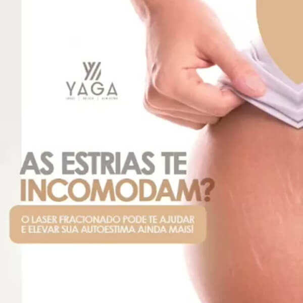 As estrias te incomodam?