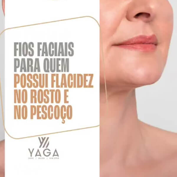 Fios faciais para quem possui flacidez no rosto e no pescoço