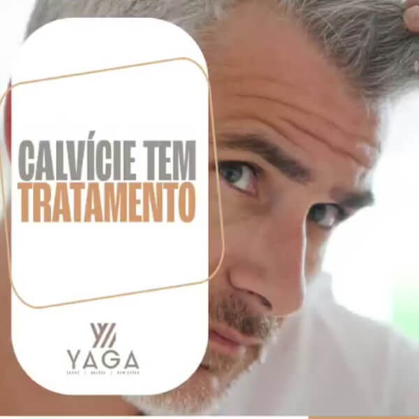 Calvície tem tratamento