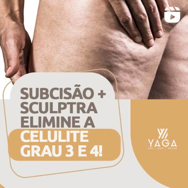 Subcis&atilde;o + sculptra - elimine a celulite grau 3 e 4!