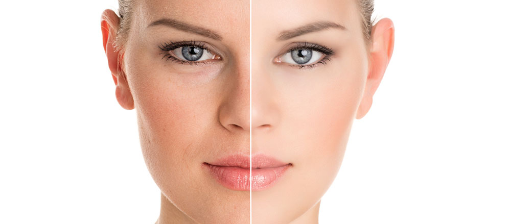 Skinboosters